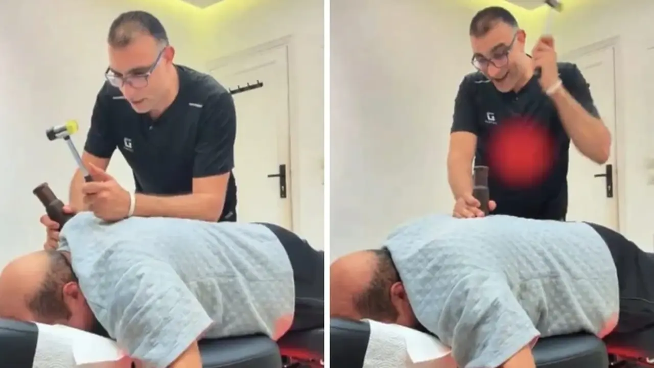 طبيب مصري يعالج مريضاً سعودياً بالمطرقة في مقطع فيديو يثير جدلاً واسعاً